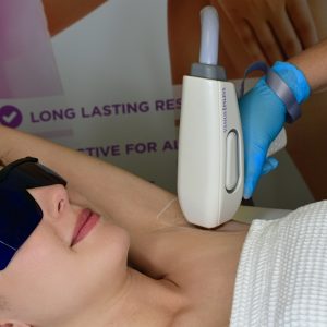 Photo Rejuvenation Under Arms IPL (30 Min)
