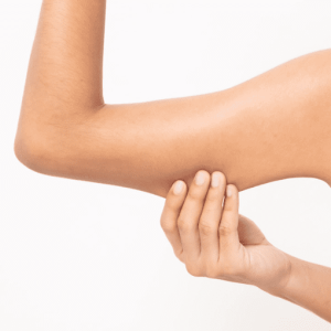 Skin Tightening-Arm (Pkg 5 sessions)