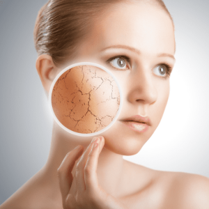 Photo Rejuvenation IPL – Package of 5 Sessions