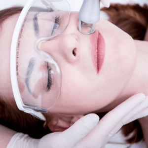 Skin Resurfacing RF Nano-Fractional – Face (50 Min)