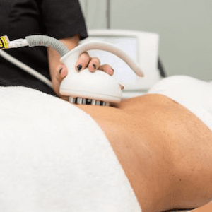 VERSA Body Slimming (Pkg 6 sessions) (50 min)