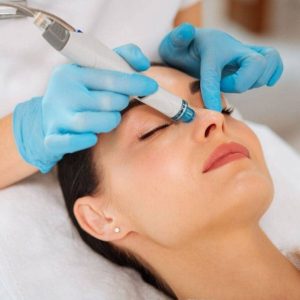 Skin Tightening and Wrinkle Reduction – Face (50 Min)