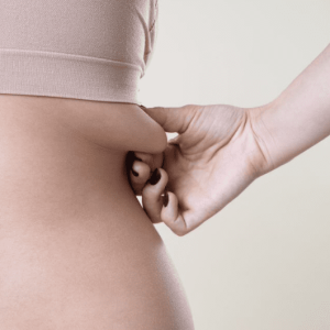 Skin Tightening – Flank (Pkg 5 Sessions)